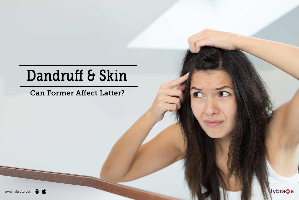 Dandruff & Skin - Can Former Affect Latter?