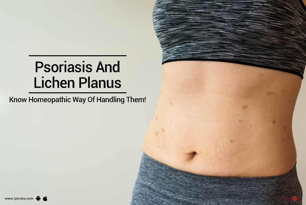Psoriasis And Lichen Planus - Know Homeopathic Way Of Handling Them!