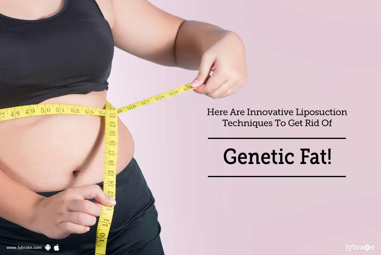 Here Are Innovative Liposuction Techniques To Get Rid Of Genetic Fat!
