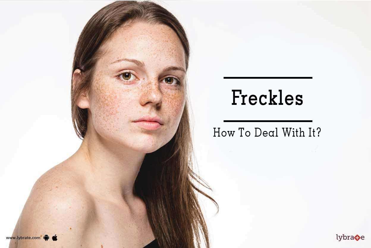 Freckles - How To Deal With It?