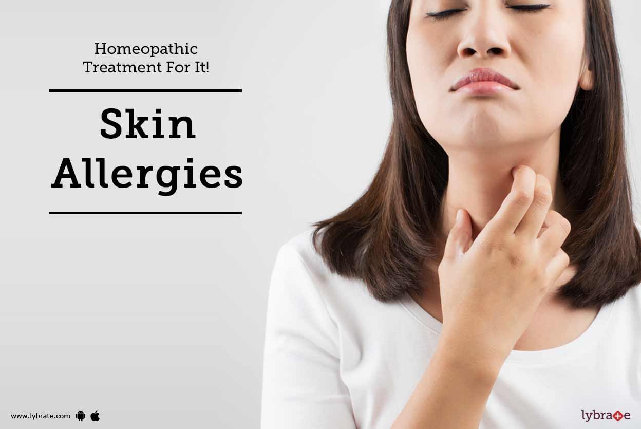 Skin Allergies - Homeopathic Treatment For It!