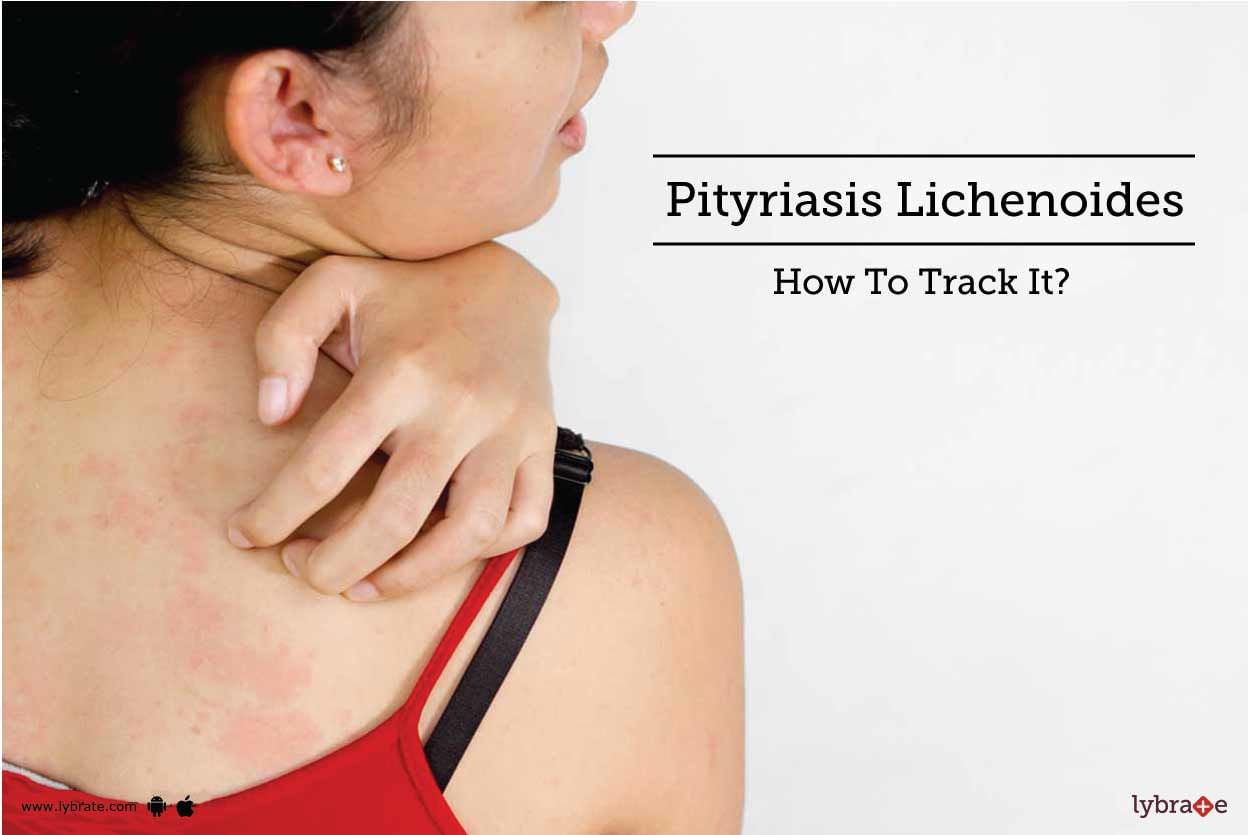 Pityriasis Lichenoides - How To Track It?