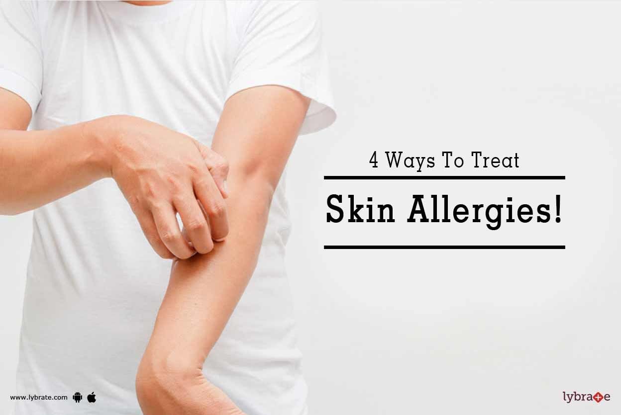 4 Ways To Treat Skin Allergies!