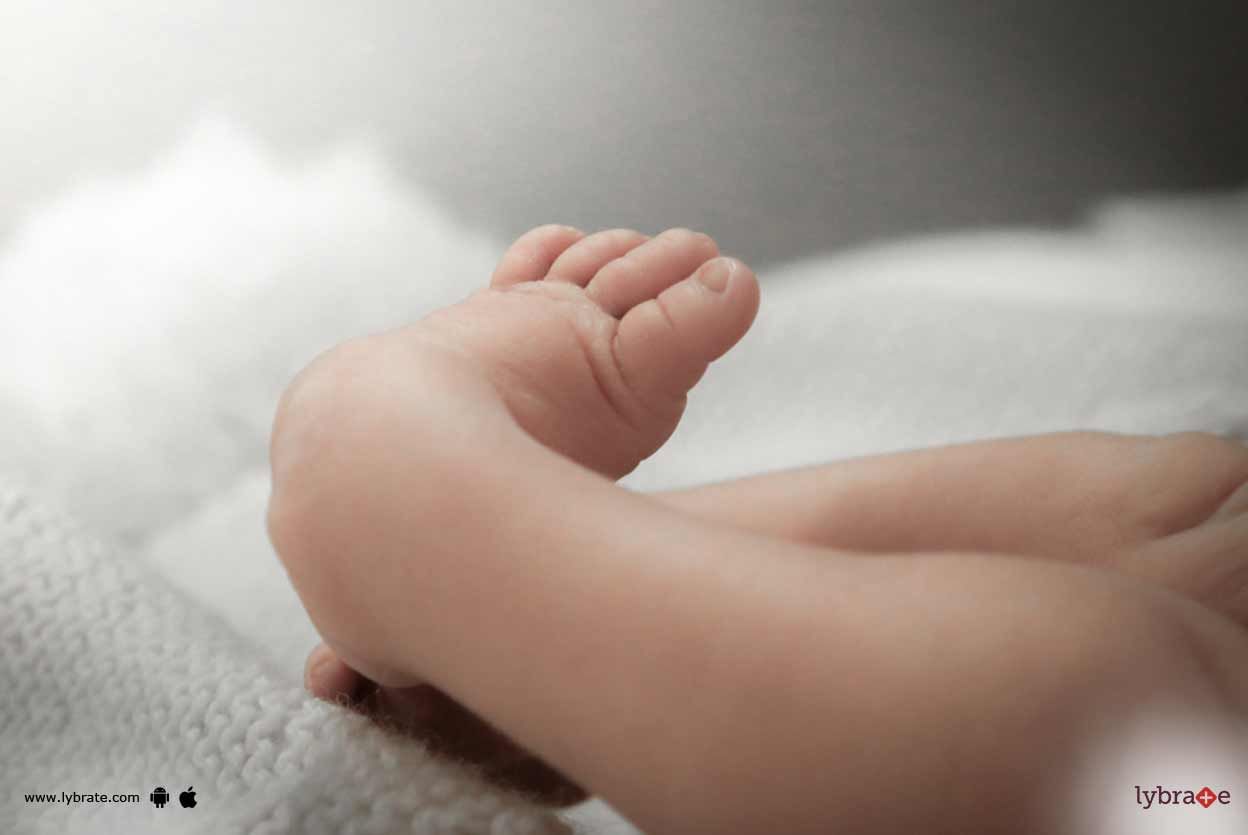 Clubfoot - How To Treat It?
