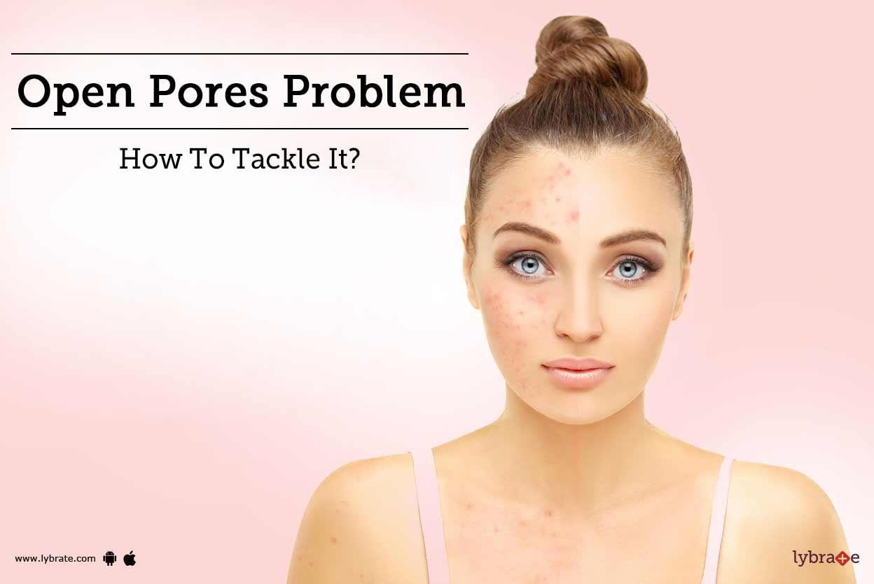 Open Pores Problem - How To Tackle It?