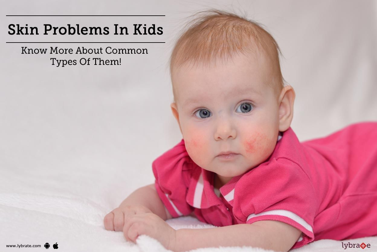 Skin Problems In Kids - Know More About Common Types Of Them!