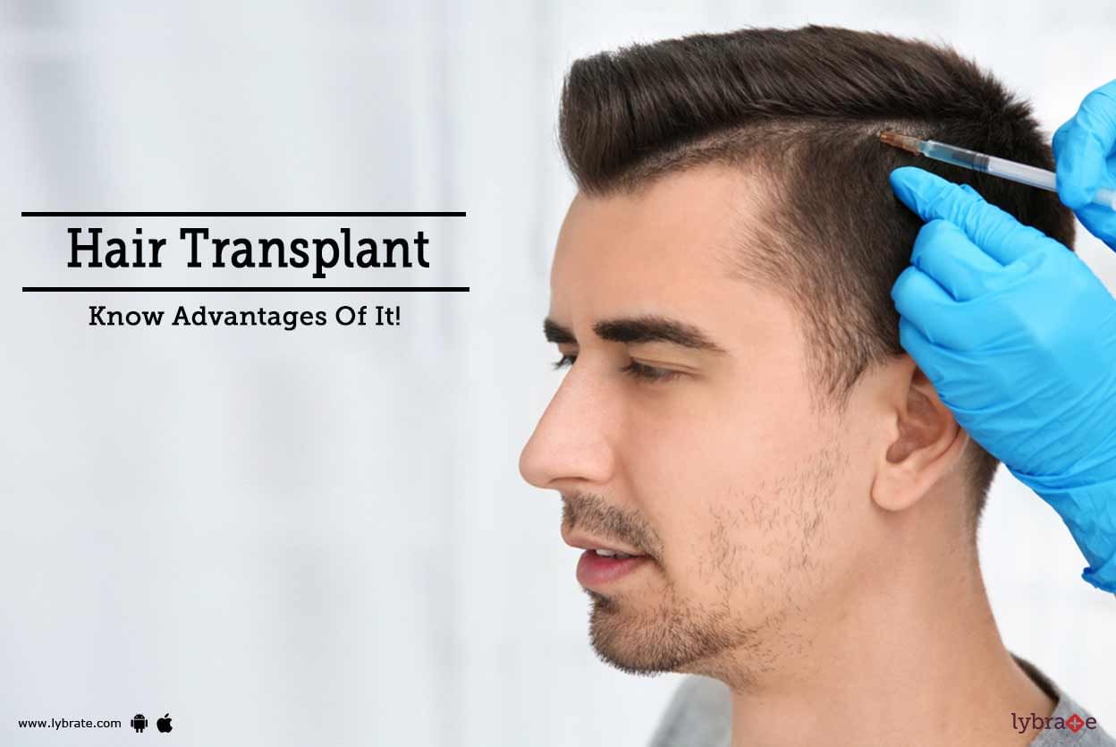 Hair Transplant - Know Advantages Of It!