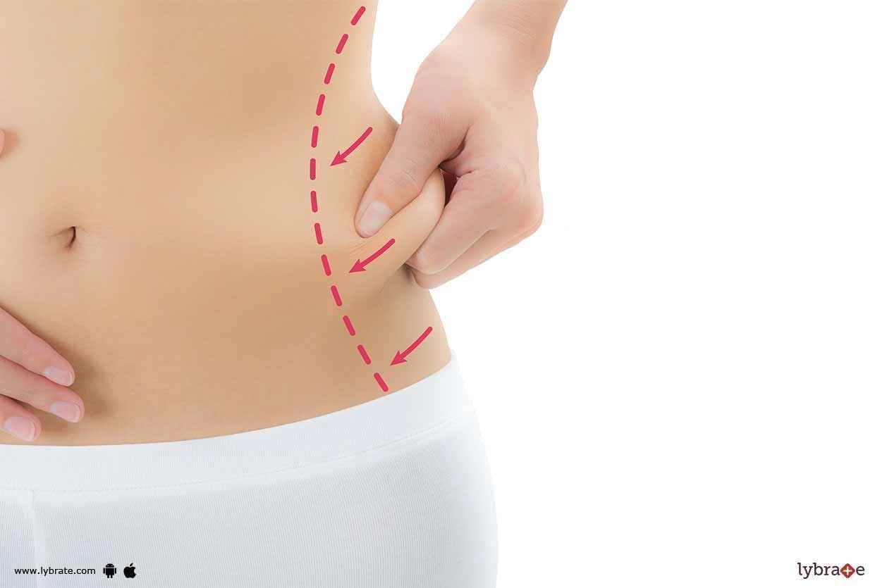 Liposuction - Why To Give It A try?