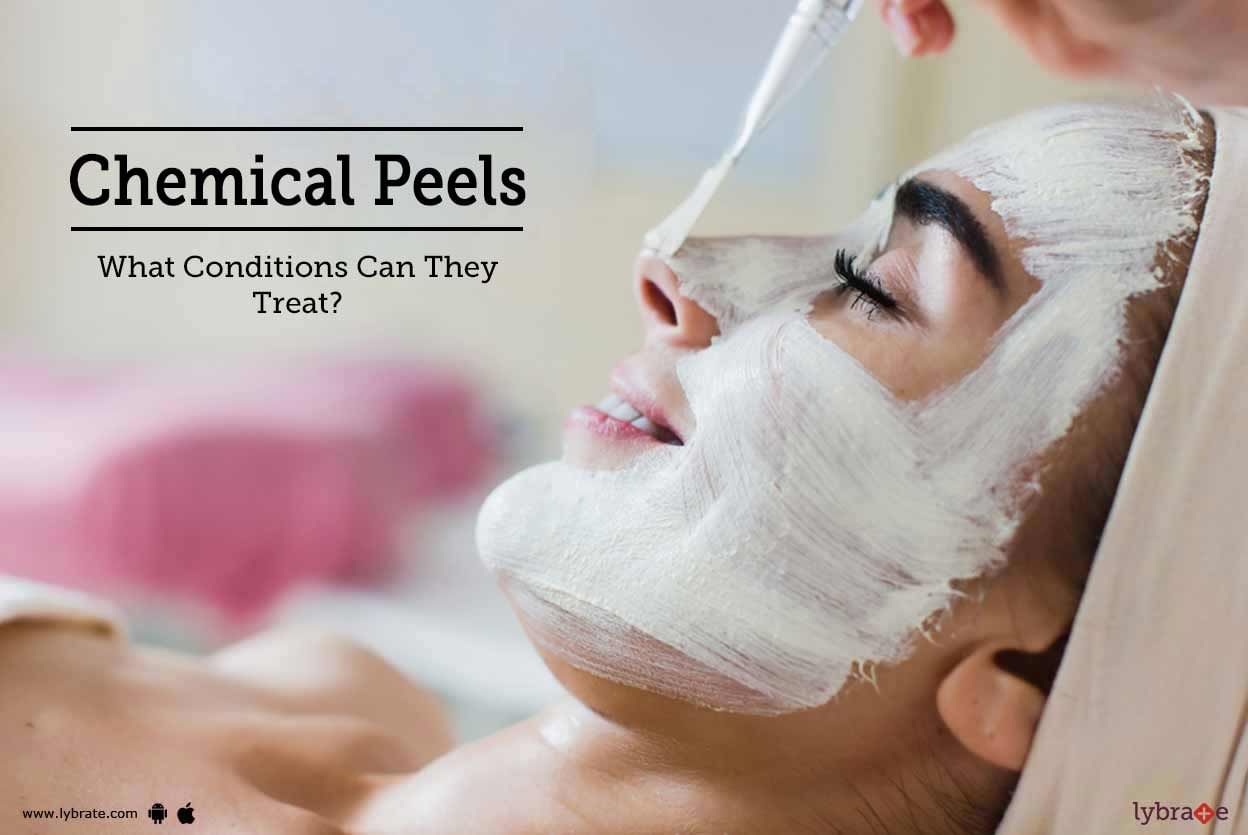 Chemical Peels - What Conditions Can They Treat?