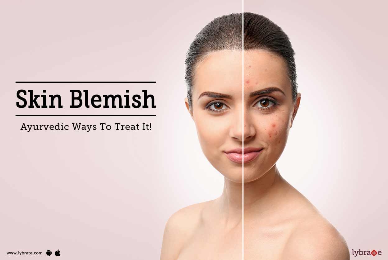 Skin Blemish - Ayurvedic Ways To Treat It!