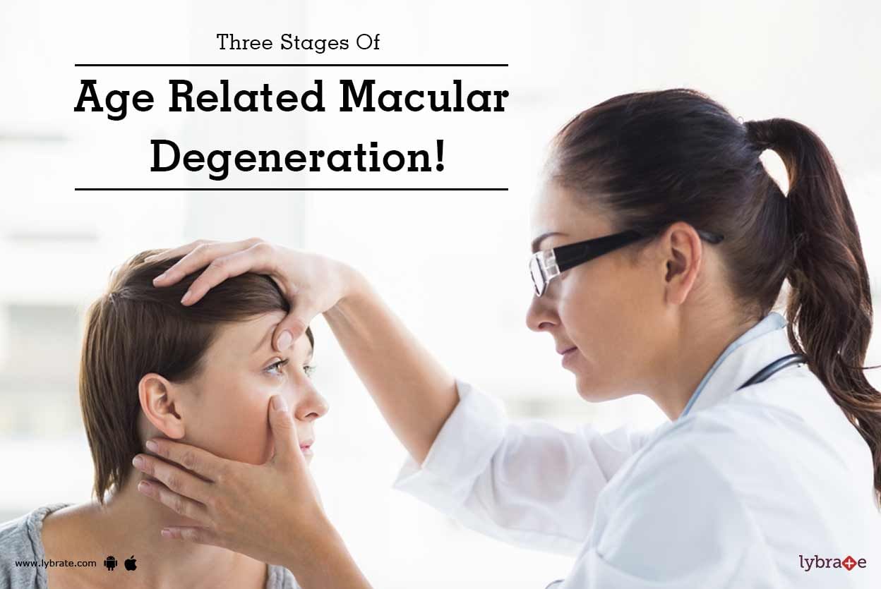 Three Stages Of Age Related Macular Degeneration!