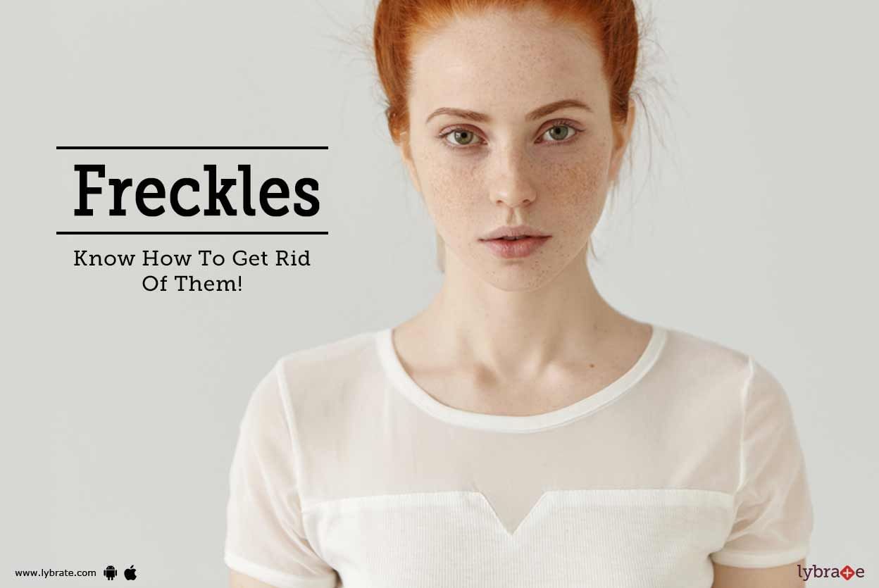 Freckles - Know How To Get Rid Of Them!