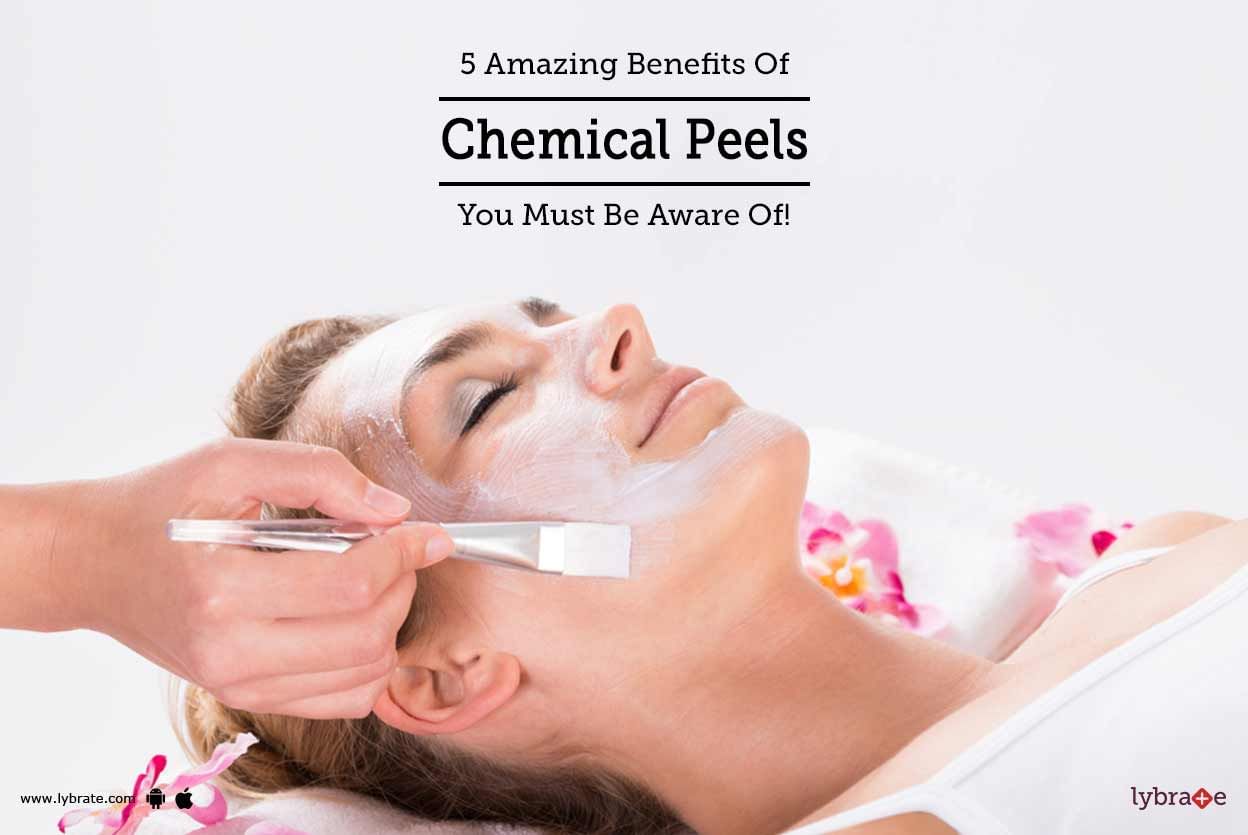 5 Amazing Benefits Of Chemical Peels You Must Be Aware Of!