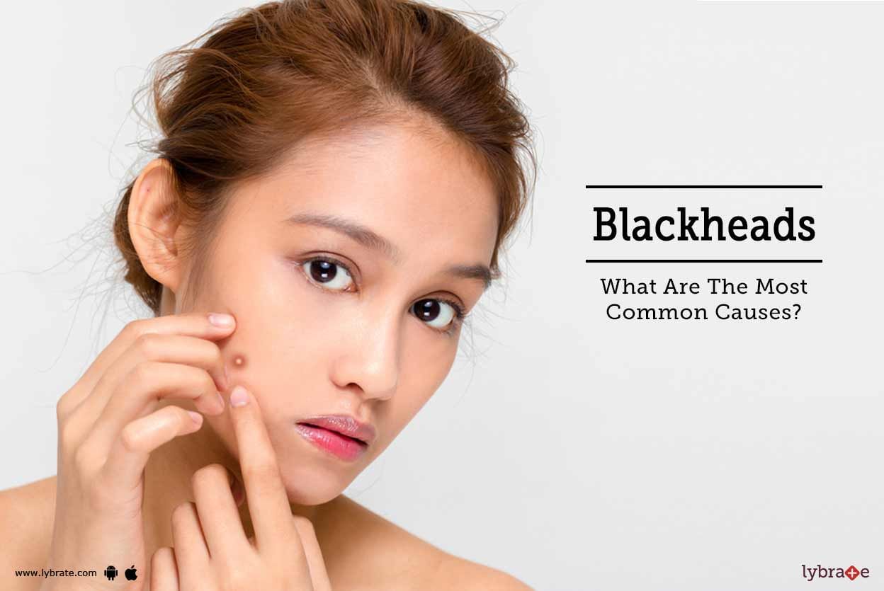 Blackheads - What Are The Most Common Causes?