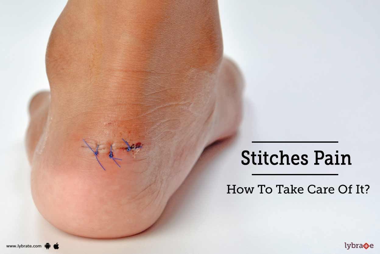 Stitches Pain - How To Take Care Of It?