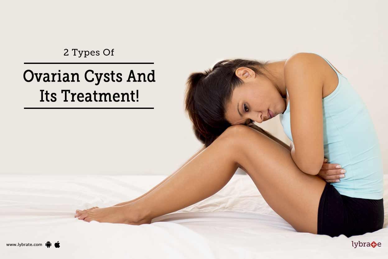 2 Types Of Ovarian Cysts And Its Treatment!