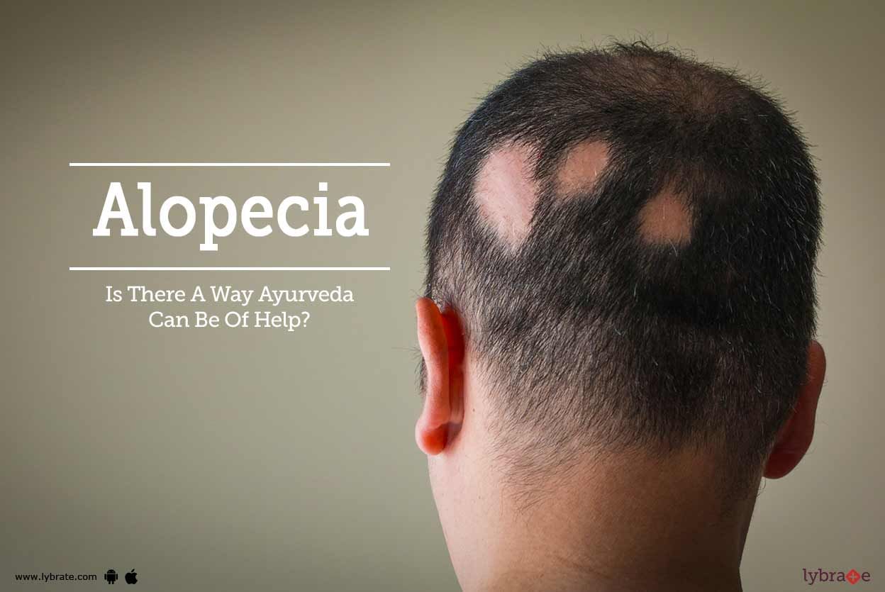 Alopecia - Is There A Way Ayurveda Can Be Of Help?