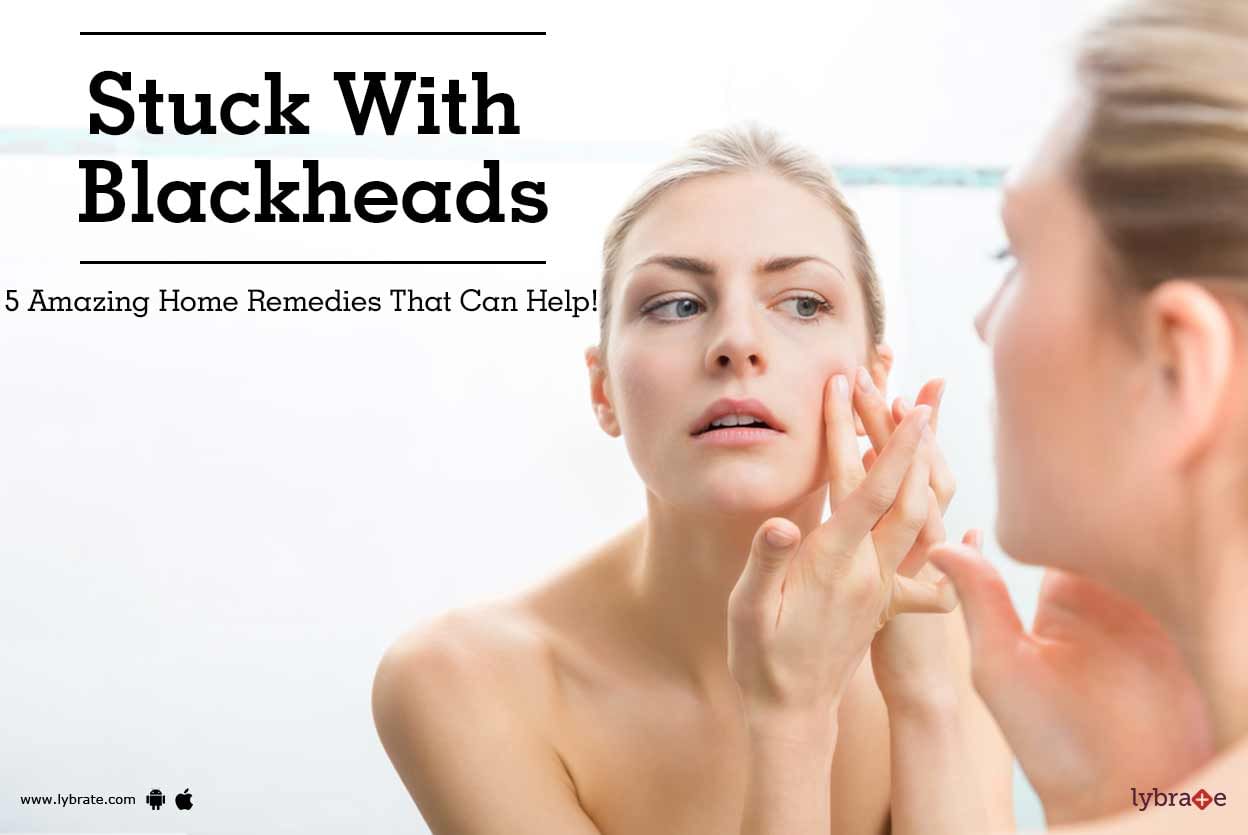 Stuck With Blackheads - 5 Amazing Home Remedies That Can Help!