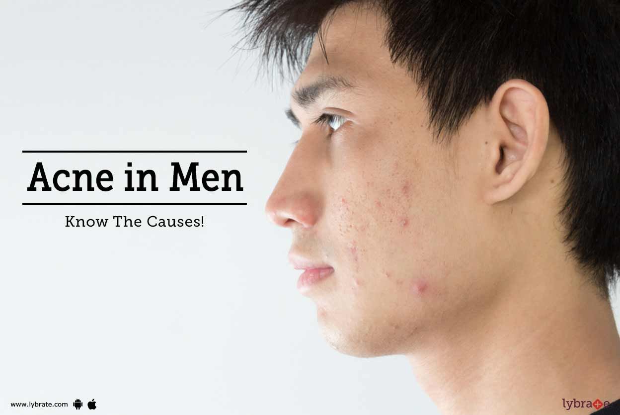 Acne in Men - Know The Causes!
