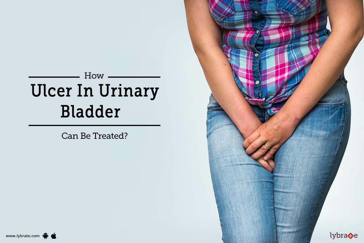 How Ulcer In Urinary Bladder Can Be Treated? - By Dr. D.K. Agarwal ...