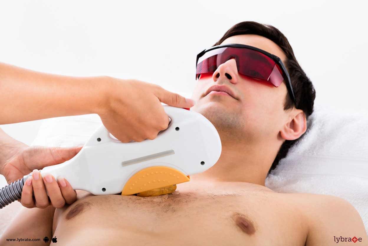 What Men Need To Know About Laser Hair Removal?