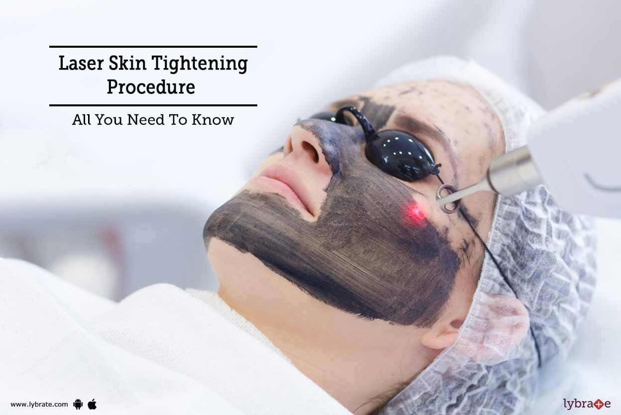 Laser Skin Tightening Procedure - All You Need To Know