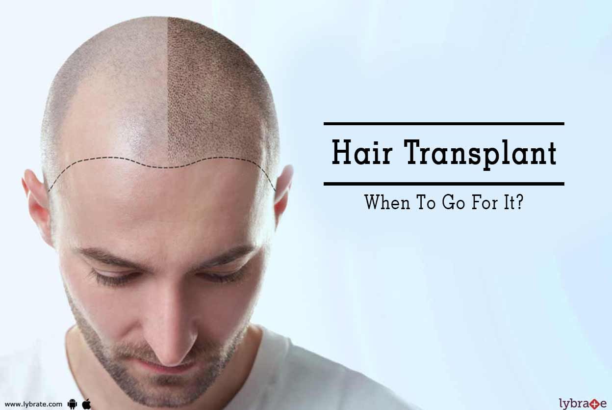 Hair Transplant - When To Go For It?