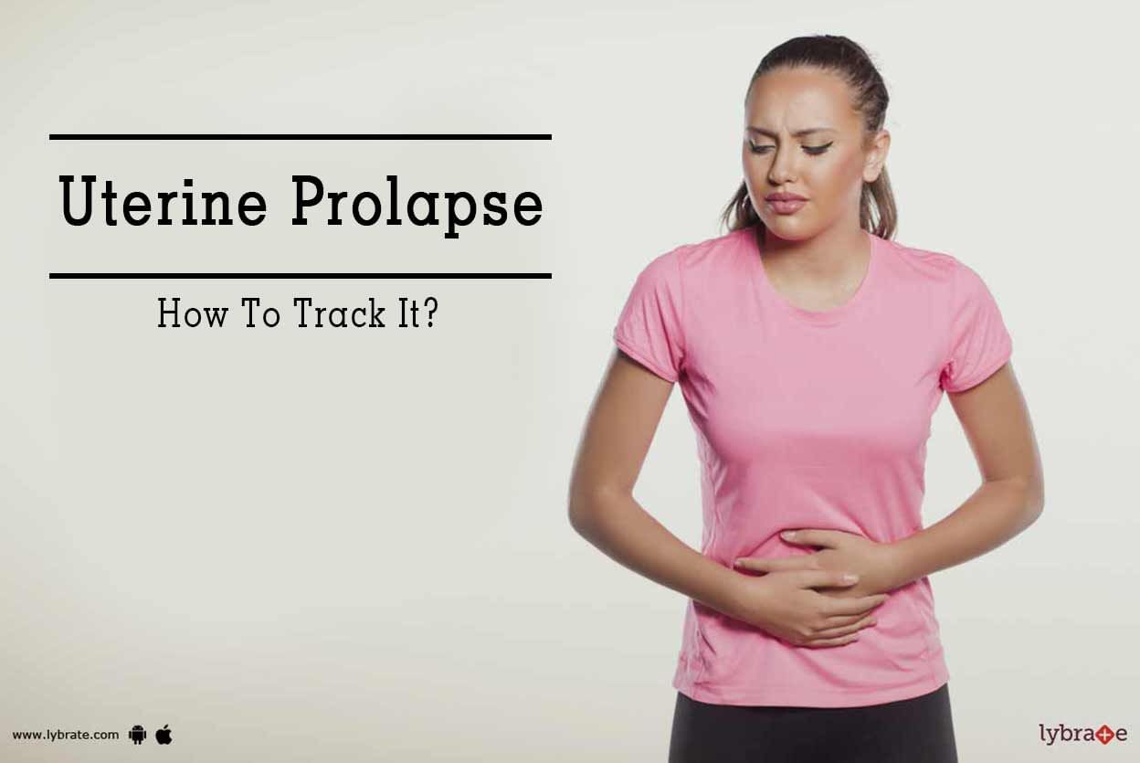 Uterine Prolapse - How To Track It?