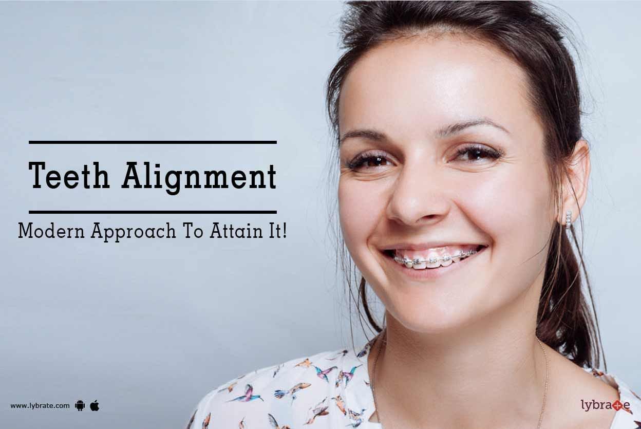 Teeth Alignment - Modern Approach To Attain It!