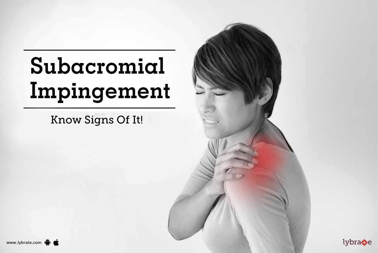 Subacromial Impingement - Know Signs Of It!