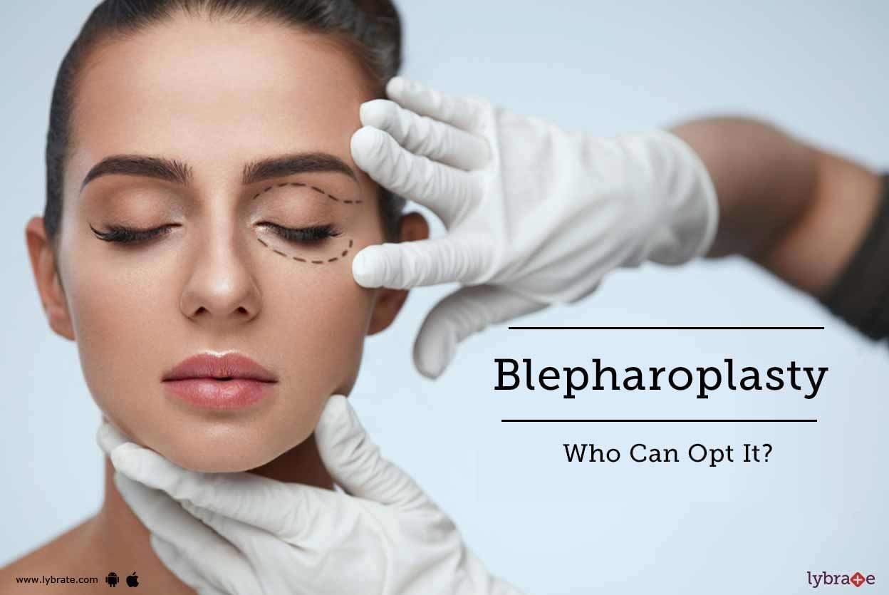 Blepharoplasty - Who Can Opt It?