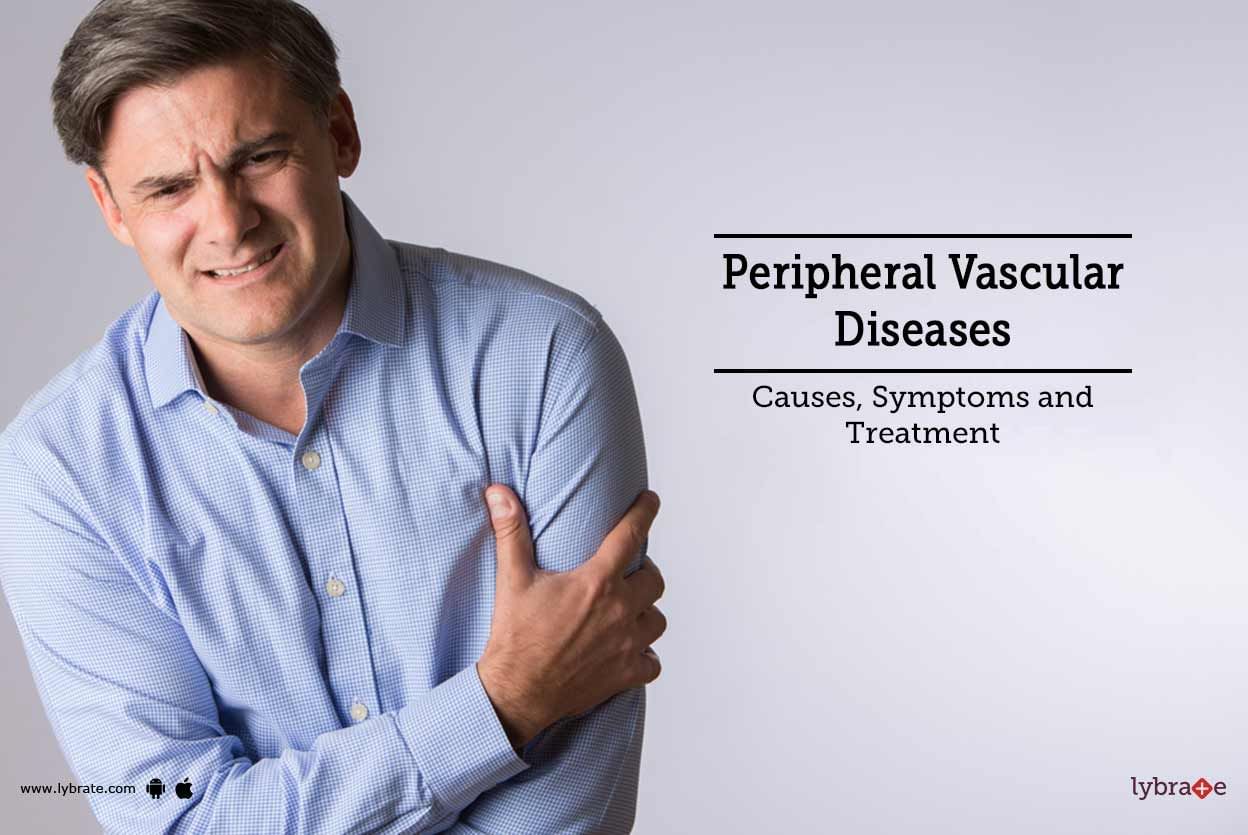 Peripheral Vascular Diseases: Causes, Symptoms and Treatment