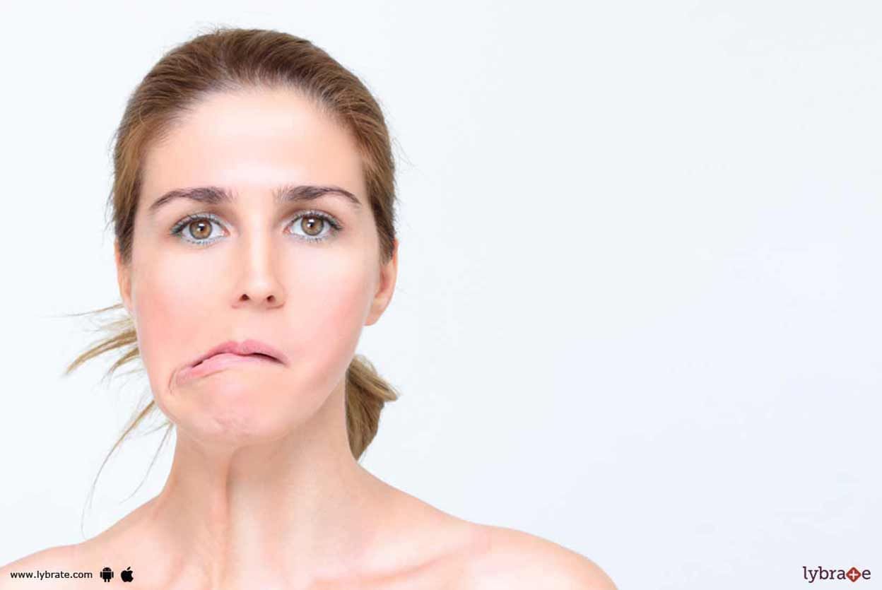 Bell's Palsy - Know More About It!