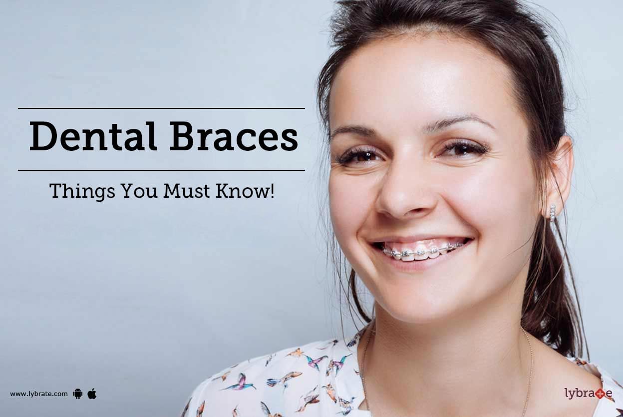 Dental Braces - Things You Must Know!