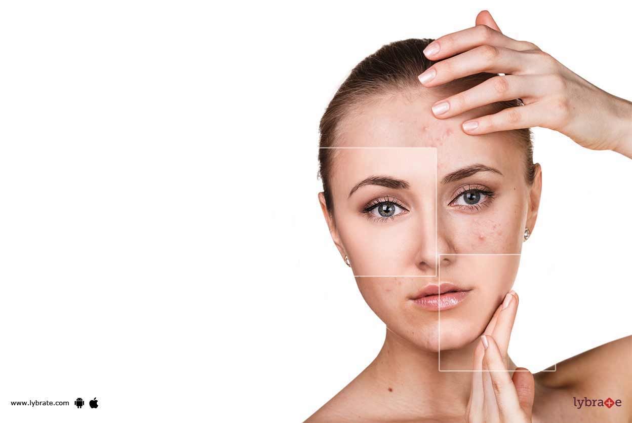 Skin Problems - How Can Homeopathy Avert Them?