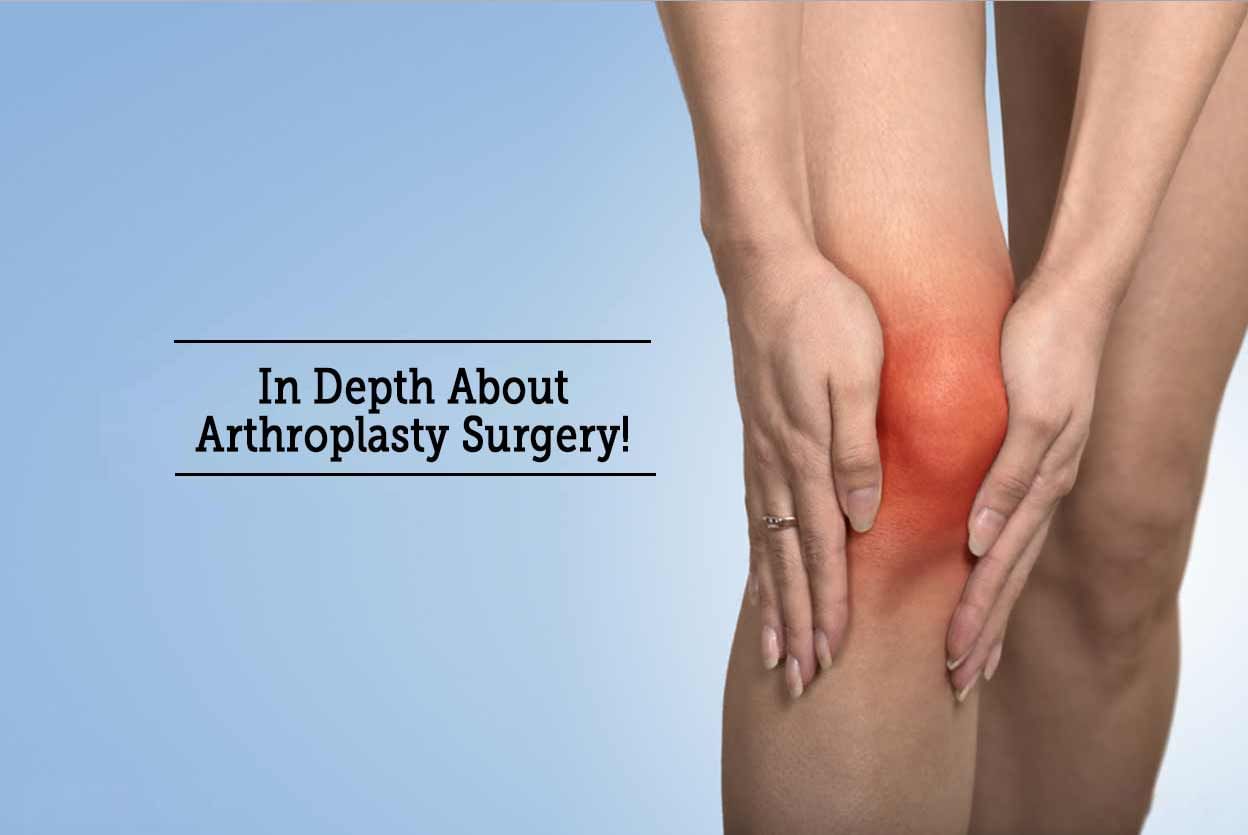 In Depth About Arthroplasty Surgery!