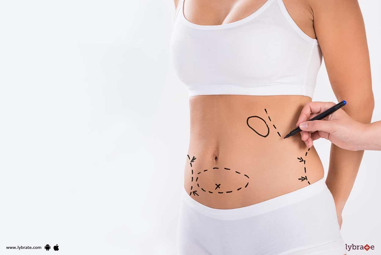 Liposuction - Know The Benefits And Risks Of It!