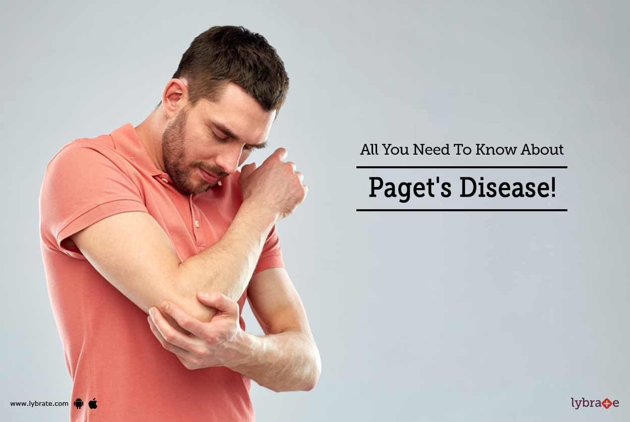 All You Need To Know About Paget's Disease!