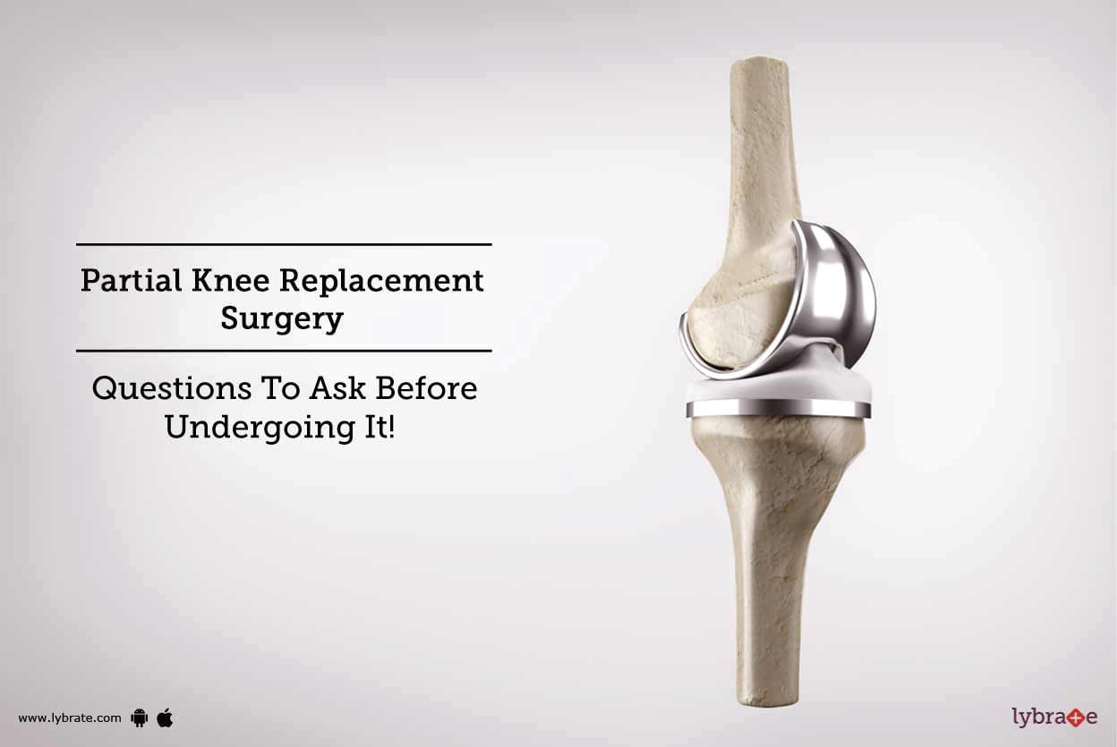 Partial Knee Replacement Surgery - Questions To Ask Before Undergoing It!