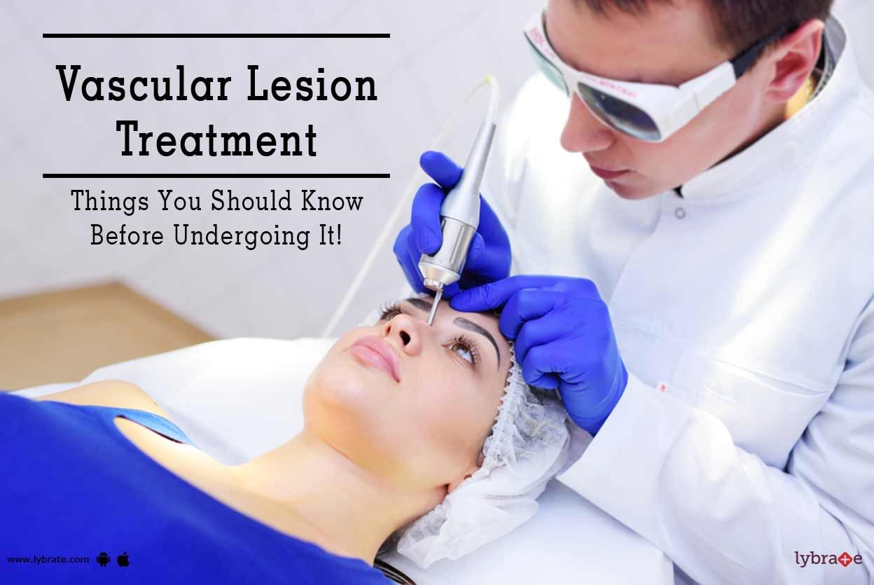 Vascular Lesion Treatment - Things You Should Know Before Undergoing It!