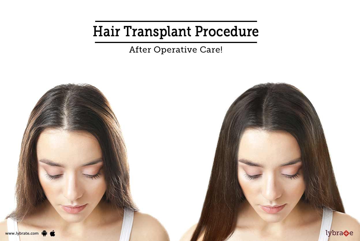 Hair Transplant Procedure - After Operative Care!
