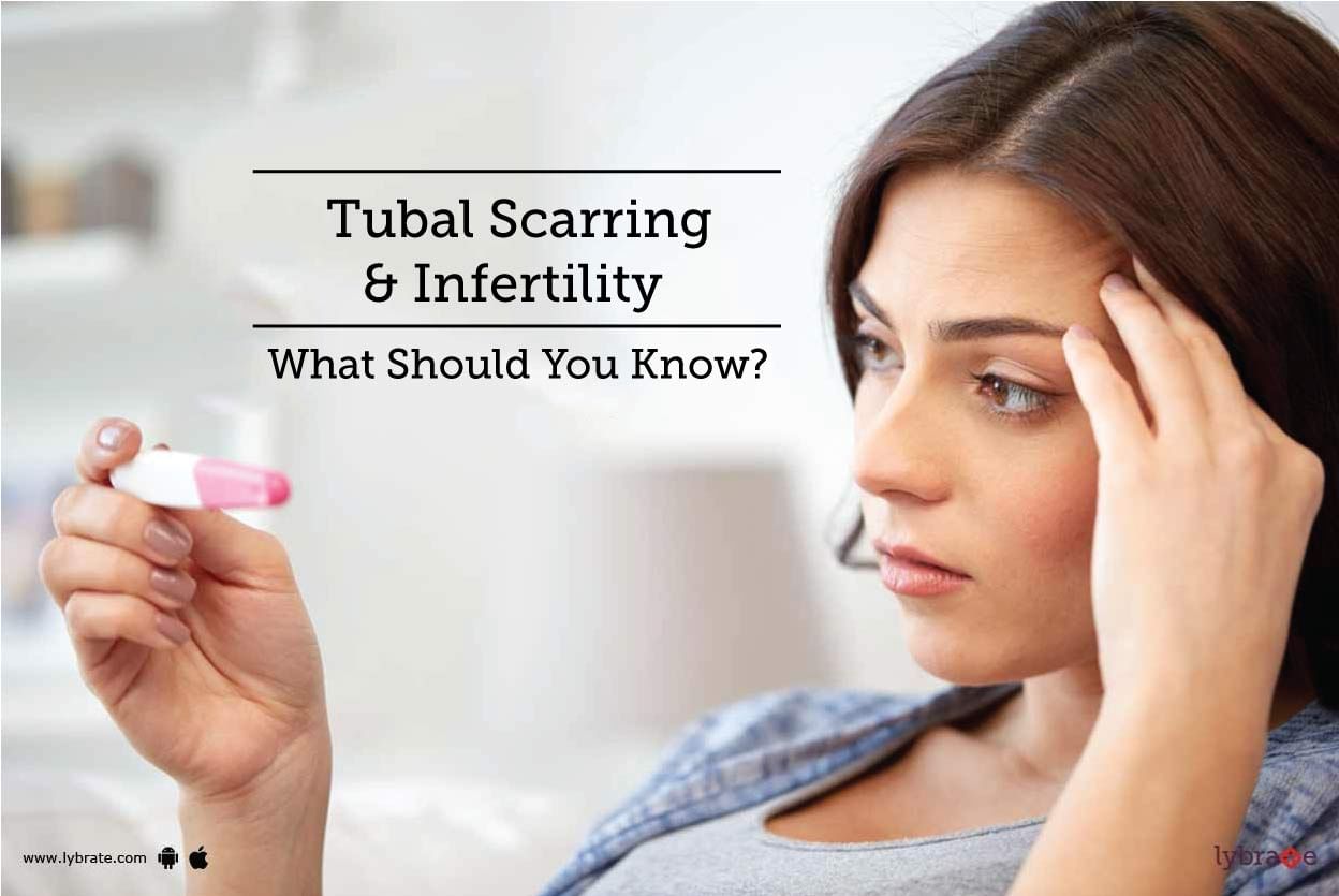 Tubal Scarring & Infertility - What Should You Know?