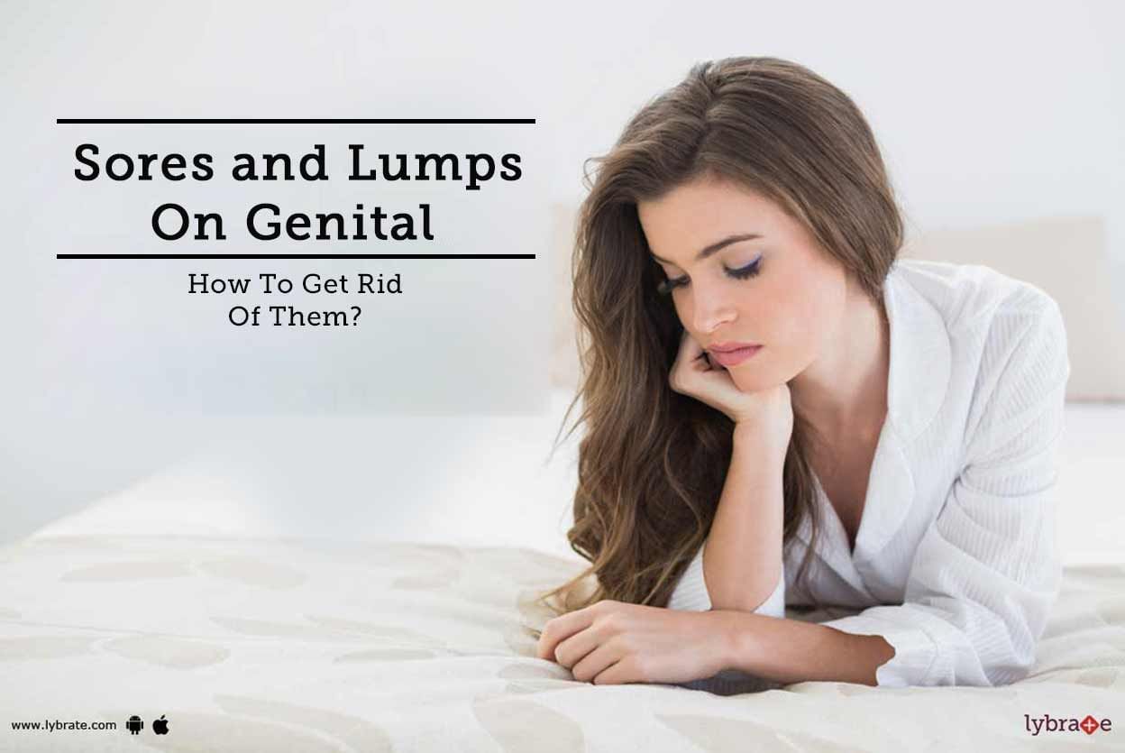 Sores And Lumps On Genital - How To Get Rid Of Them?