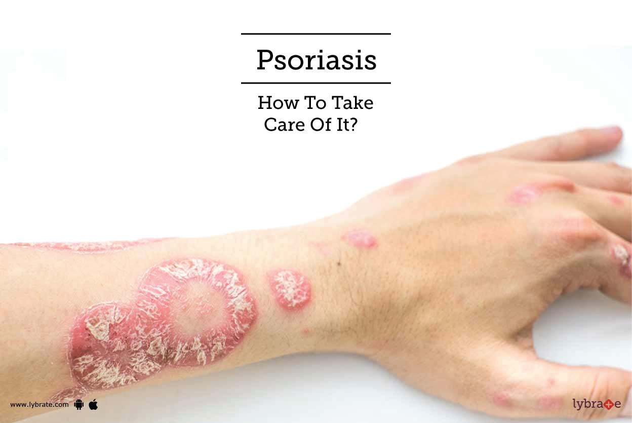 Psoriasis - How To Take Care Of It?