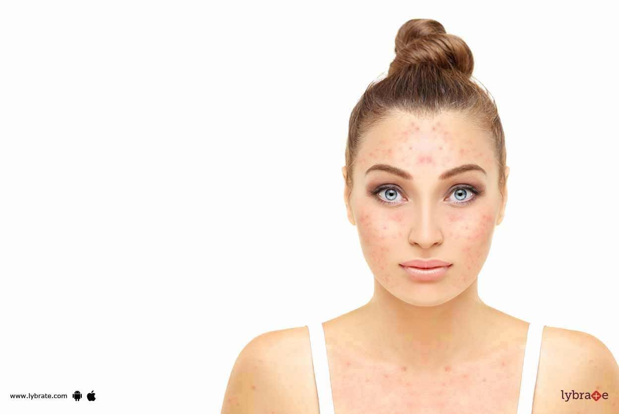 Pigmentation Problems - What Should You Know?