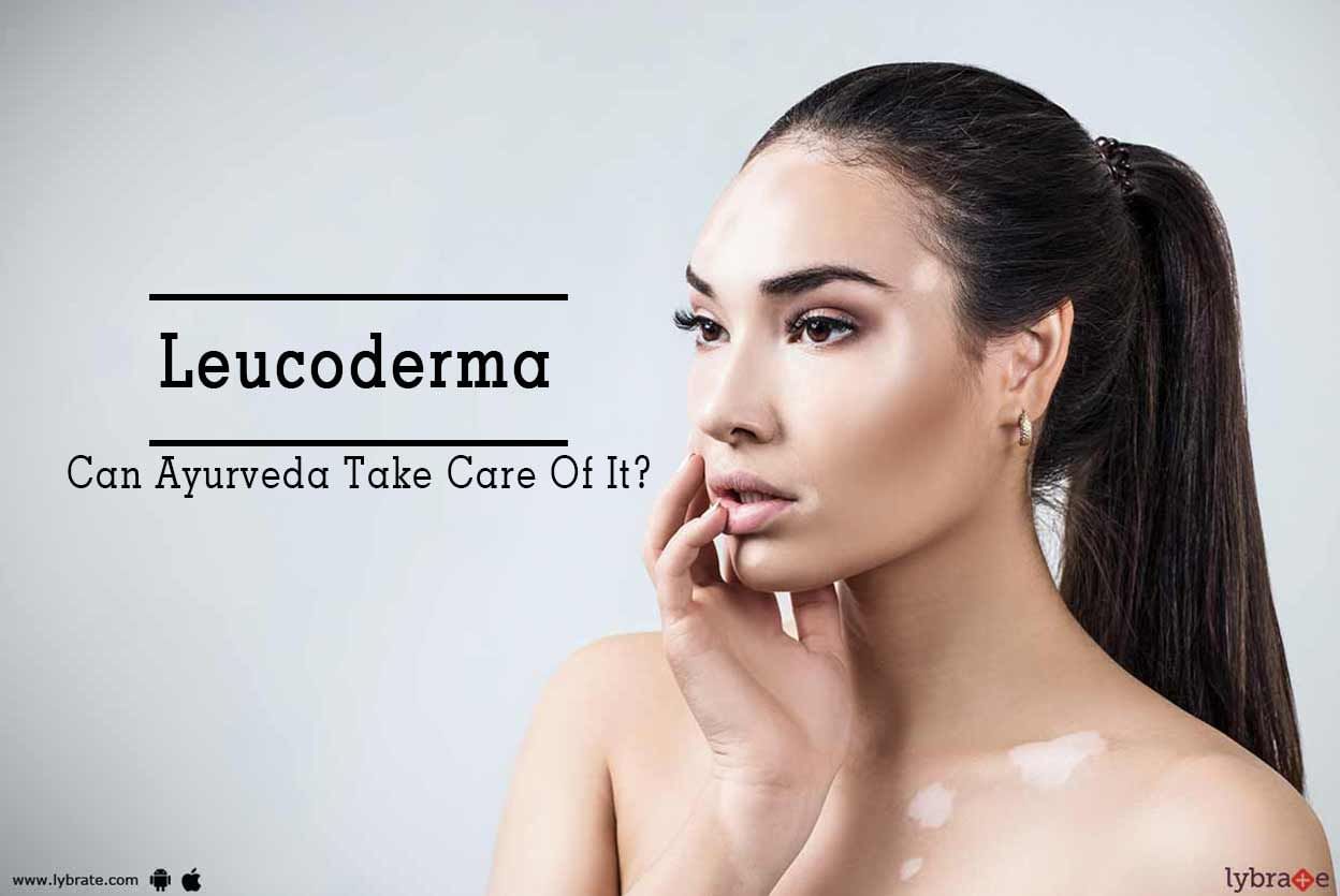 Leucoderma - Can Ayurveda Take Care Of It?