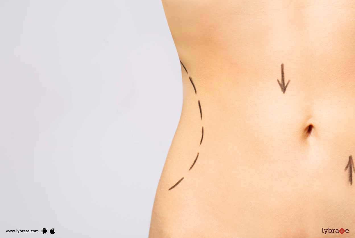 Body Contouring - Know More About It!