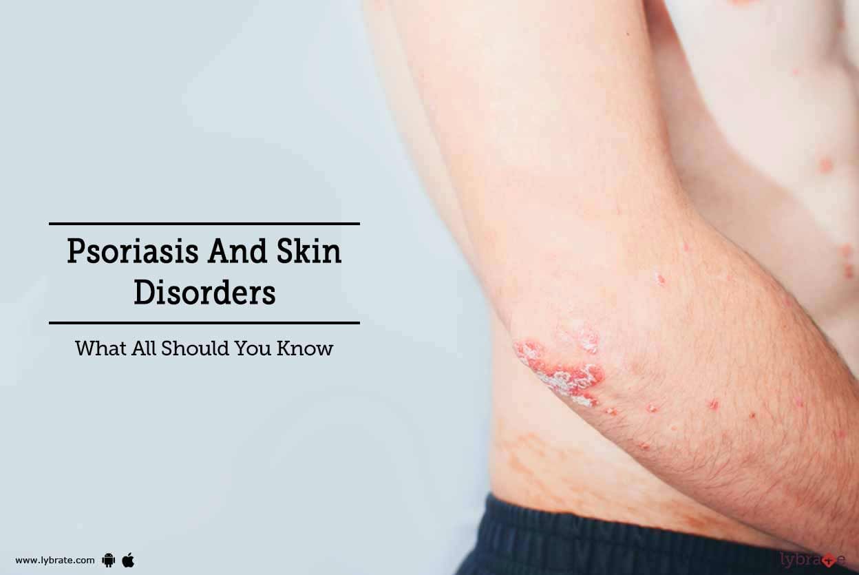 Psoriasis And Skin Disorders - What All Should You Know