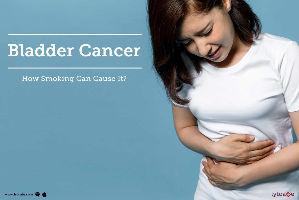 Bladder Cancer - How Smoking Can Cause It?