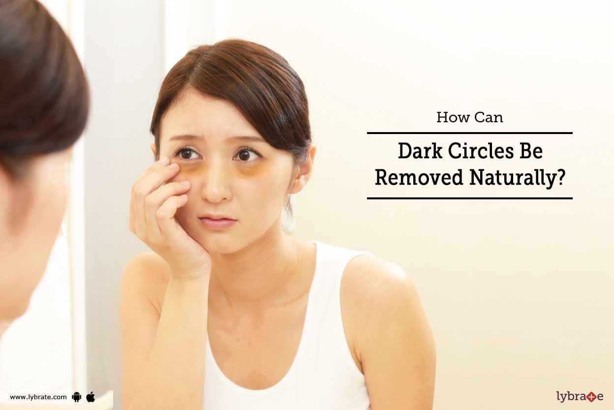 How Can Dark Circles Be Removed Naturally?